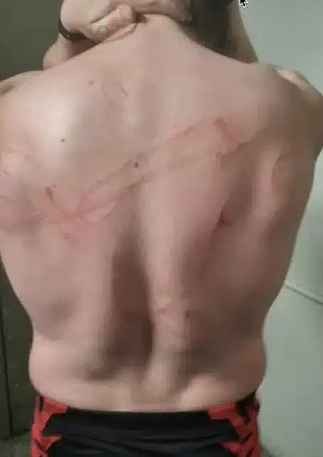 Why Goldberg Sucks, Liv Morgan Matters, and AEW Needs a Map 1 Johnny North'S Lacerations On His Back Resulting From His Strap Match