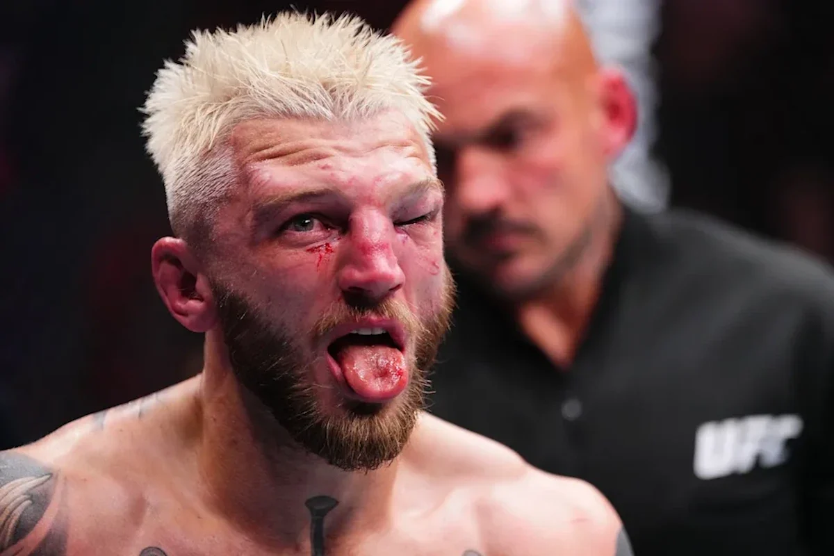 Dan Hooker Suffered A Broken Nose At Ufc Quatr